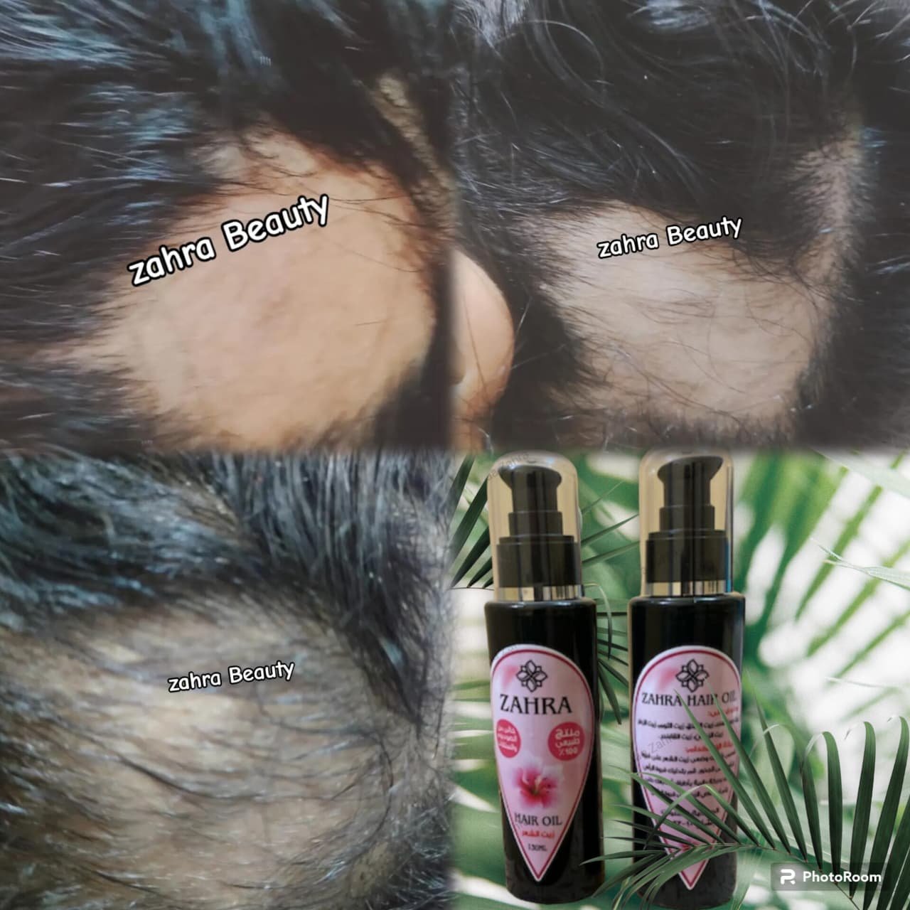 زيت الانبات hair loss oil
لتكثيف الشعر ووقف التساقط - الصورة 2