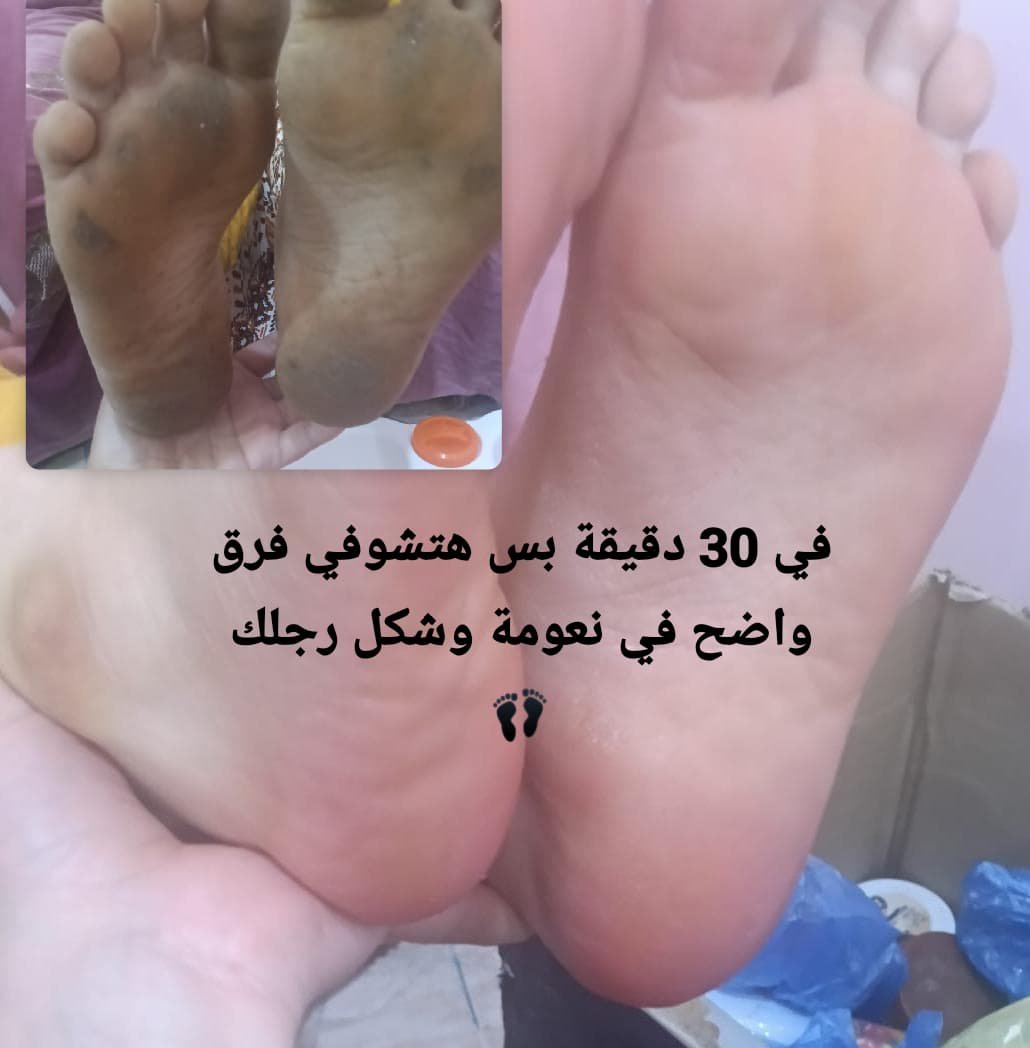 Foot peeling
مقشر القدم الفوري - الصورة 5